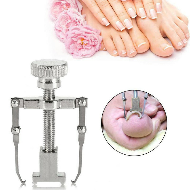 Ingrown Toenail Manicure Pedicure Foot Care Correction Brace Tool Toe Clipper Foot Nails Care Tool